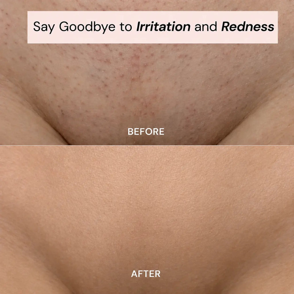 Ylumea 2-in-1 - Intimate Hair Remover